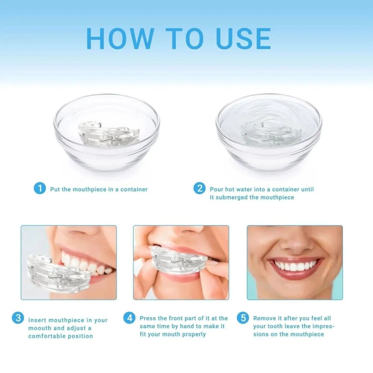 SNOREFREE PRO – Anti-Snoring Mouthpiece for Sleep Apnea & Snoring