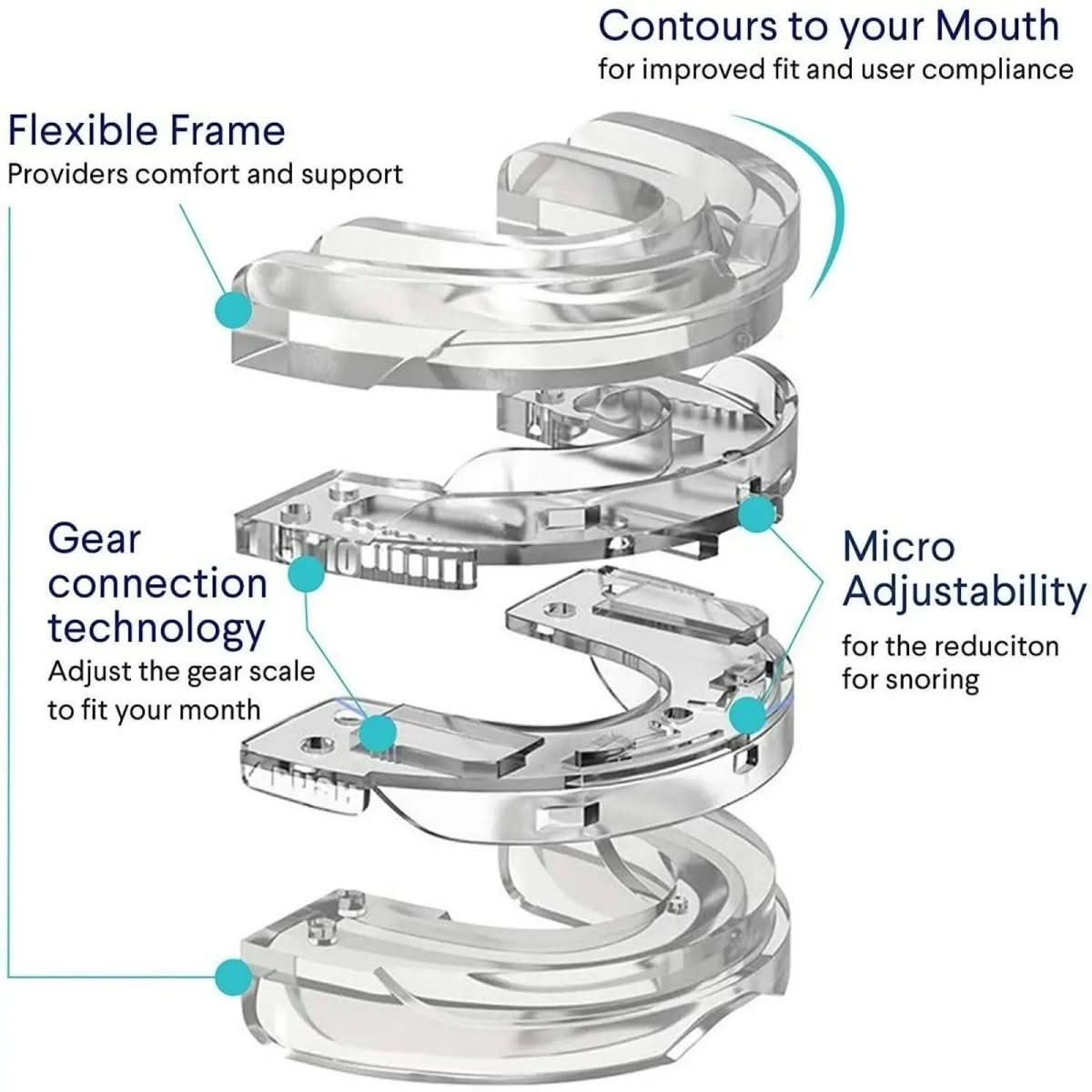 SNOREFREE PRO – Anti-Snoring Mouthpiece for Sleep Apnea & Snoring
