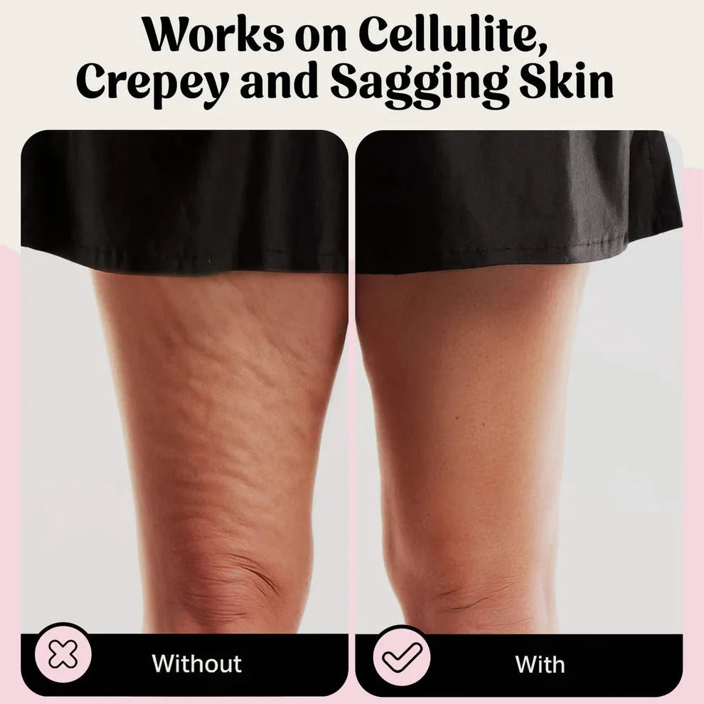 VellaShape™ Body Tape